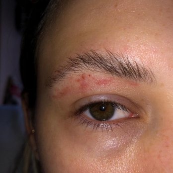 Flybrow - My right eyebrow on Nov. 9, two mornings after my brow lamination and shaping at Flybrow. - Eyebrow Services Near Me Flybrow - My right eyebrow on Nov. 9, two mornings after my brow lamination and shaping at Flybrow. - Eyebrow Services Near Me