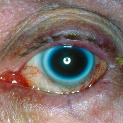 Roth Vision Care