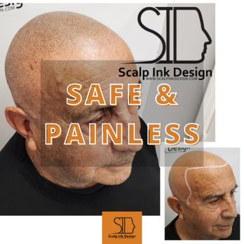 Scalp Ink Design - Hair Loss Centers Near Me - Miami, Florida Scalp Ink Design - Hair Loss Centers Near Me - Miami, Florida