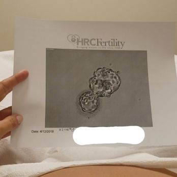 HRC Fertility - Carlsbad - Have you ever seen a cuter more perfect blastocyst? - Fertility Near Me - Carlsbad, California HRC Fertility - Carlsbad - Have you ever seen a cuter more perfect blastocyst? - Fertility Near Me - Carlsbad, California
