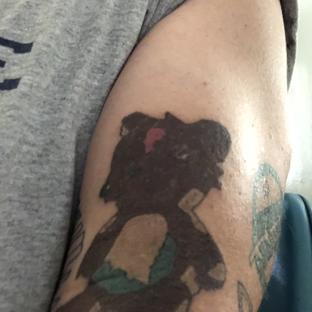 St Pete Tattoo Removal - First session of "Bobo" was 4 days ago... Ink will break down far more as next session draws near in early September. - Tattoo Removal Near Me - Pinellas Park, Florida St Pete Tattoo Removal - First session of "Bobo" was 4 days ago... Ink will break down far more as next session draws near in early September. - Tattoo Removal Near Me - Pinellas Park, Florida