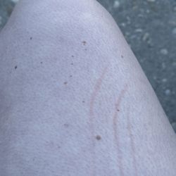Summer Girl - Dog scratch