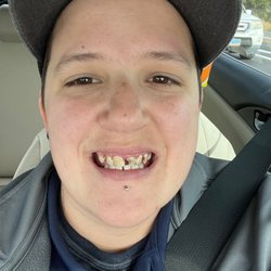 Western Dental & Orthodontics - Before surgery!