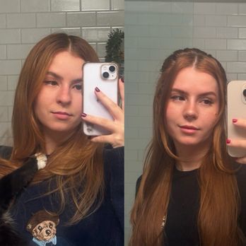 Profiles Beverly Hills Plastic Surgery - Front view before & after - Plastic Surgeons Near Me - Beverly Hills, California