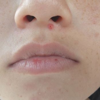 KidShine Orthodontics - Resting mouth normally with the most comfort I can get - Orthodontists Near Me - Pearl City, Hawaii KidShine Orthodontics - Resting mouth normally with the most comfort I can get - Orthodontists Near Me - Pearl City, Hawaii