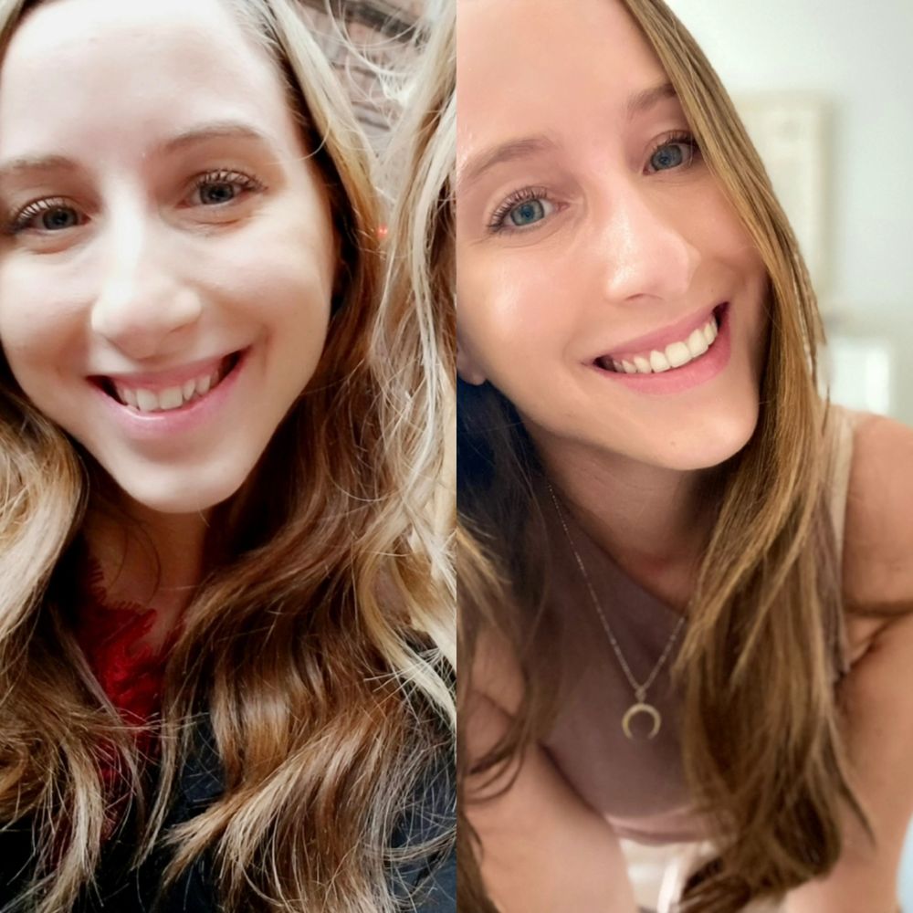 PROHEALTH DENTAL Updated September 2024 31 Reviews 2914 Ditmars Blvd, Astoria, New York