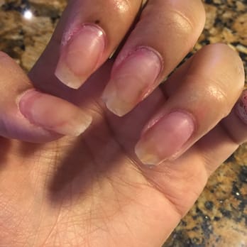 Cosmo Nail Bar - My gross nails. This is what happens when your nails don't get replaced every six weeks - Nail Salons Near Me - Annapolis, Maryland Cosmo Nail Bar - My gross nails. This is what happens when your nails don't get replaced every six weeks - Nail Salons Near Me - Annapolis, Maryland