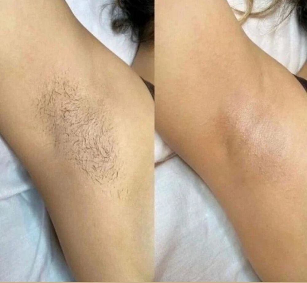 Bare Waxing Logo