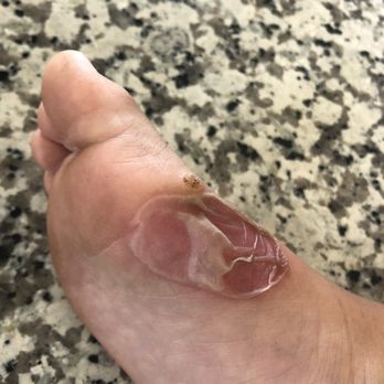 Stockdale Podiatry Group - Negligence - Podiatrists Near Me - Bakersfield, California Stockdale Podiatry Group - Negligence - Podiatrists Near Me - Bakersfield, California