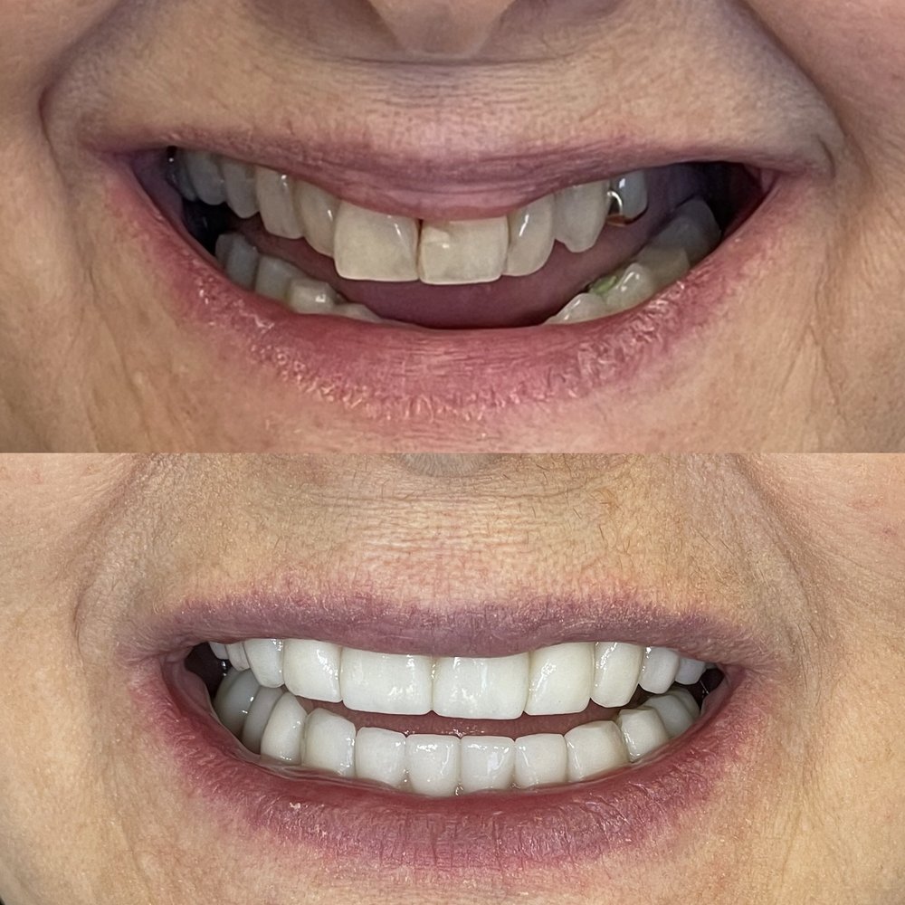 TOP 10 BEST Dentists near East Solano Ave, Berkeley, CA - Updated 2026 -  Yelp