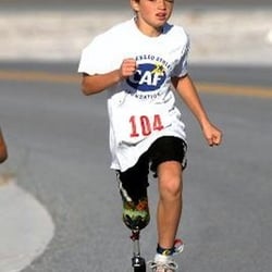 Complete Orthopedic Services - Pediatric Prosthetics for upper/lower extremities. Cosmetic Prosthetics for fingers, toes and facial
