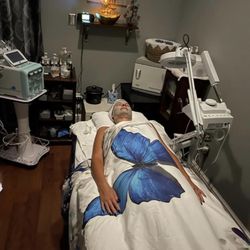 Living The Dream Salon - HYDRODERM Abrasion Facial