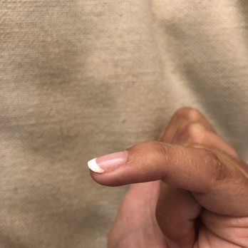 Trendy Nails & Lash - Chipped & peeling near cuticles - Eyelash Service Near Me - Denver, Colorado Trendy Nails & Lash - Chipped & peeling near cuticles - Eyelash Service Near Me - Denver, Colorado