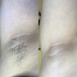 Angel Esthetics