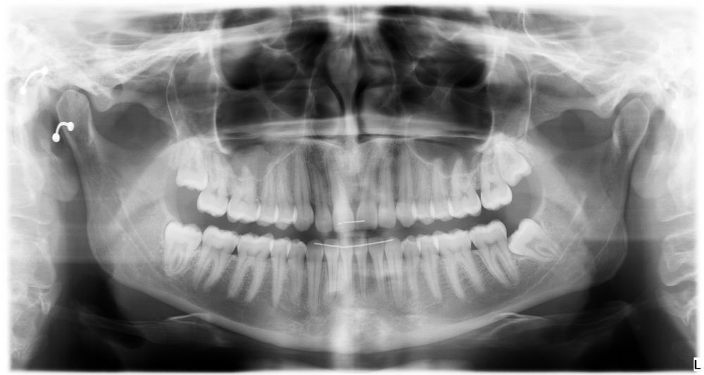 Mosaic - Maxillofacial Surgical Arts & Implant Centers - sleep specialist in Clearwater, FL