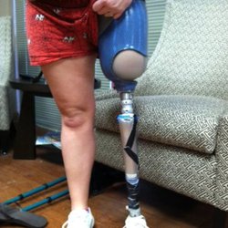CFI Prosthetics & Orthotics