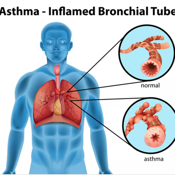 Baz Allergy, Asthma & Sinus Center - Allergists Near Me - Merced, California Baz Allergy, Asthma & Sinus Center - Allergists Near Me - Merced, California