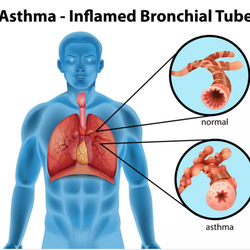 Baz Allergy, Asthma & Sinus Center