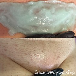 I'm now offering Jelly Mask after a bikini wax