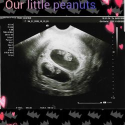Reproductive Fertility Center - Our little peanuts.  Thank you God for the blessings