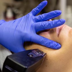 MedSpa Associates - Morpheus8