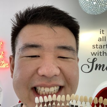 britebar - Wow I went up a couple numbers in whiteness - Teeth Whitening Near Me - Los Angeles, California britebar - Wow I went up a couple numbers in whiteness - Teeth Whitening Near Me - Los Angeles, California