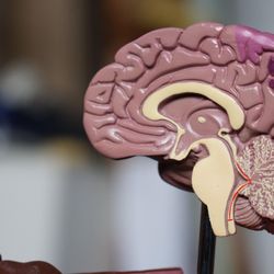 Regina Berkovich MD, PhD Inc. MS Neurology