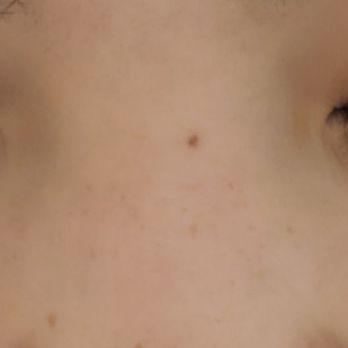 Lash Spot - Lashes by Lucy C - two weeks in - Eyelash Service Near Me - San Francisco, California Lash Spot - Lashes by Lucy C - two weeks in - Eyelash Service Near Me - San Francisco, California