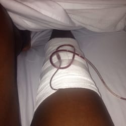 Knee post op!