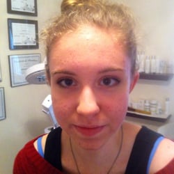 Johanna's Skin Care - After treatments