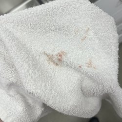 Exer Urgent Care - Westlake Village - Towel from exer, with my ear blood while still in the room, immediately after being irrigated and rupturing my ear.