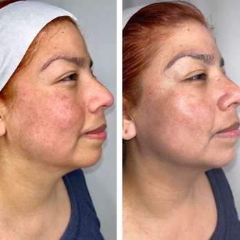 Burke Ramos Wellness Studio - Permanent Makeup Near Me - West Hollywood, California Burke Ramos Wellness Studio - Permanent Makeup Near Me - West Hollywood, California