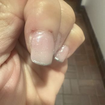 Bella Nails - This is on my other hand he cut me on 2 different fingers but the other one won't stop bleeding I've done everything. - Nail Salons Near Me - Baldwin Park, California Bella Nails - This is on my other hand he cut me on 2 different fingers but the other one won't stop bleeding I've done everything. - Nail Salons Near Me - Baldwin Park, California