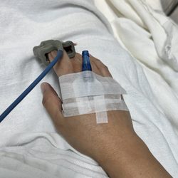 Ace Endoscopy Surgery Center