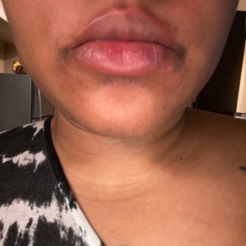 Angry Crab Shack - Swollen just from tasting it smh - Seafood Near Me - Henderson, Nevada Angry Crab Shack - Swollen just from tasting it smh - Seafood Near Me - Henderson, Nevada