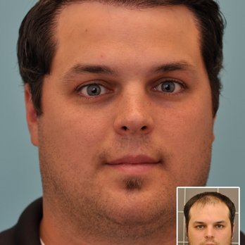 McGrath Medical - Hair Loss Centers Near Me - Austin, Texas McGrath Medical - Hair Loss Centers Near Me - Austin, Texas
