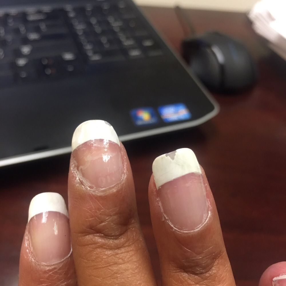 Just got them done on Monday..... Just got them done on Monday.....
