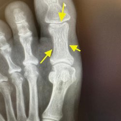 Lakeland Foot and Ankle - Dr. William S Wong, DPM, FACFAS