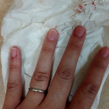 Yans Nail and Hair - Still trying to stop it after half an hour after - Nail Salons Near Me - Glendale, California Yans Nail and Hair - Still trying to stop it after half an hour after - Nail Salons Near Me - Glendale, California