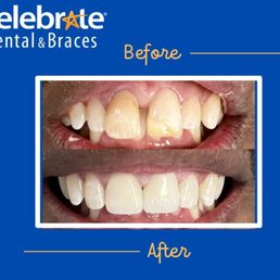 Celebrate Dental & Braces Reviews | Read Customer Service Reviews of