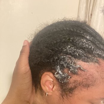 Salon Lofts In Whitehall - Her braids with all the glue on them and her bald sides. - Hair Salons Near Me - Whitehall, Ohio Salon Lofts In Whitehall - Her braids with all the glue on them and her bald sides. - Hair Salons Near Me - Whitehall, Ohio