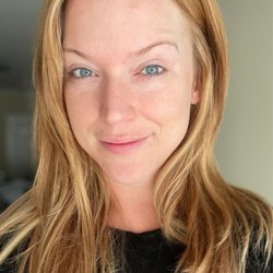 Secret Spa - Microdermabrasion and Cooling Mask - Day After Treatment