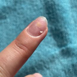 after Hard gel extensions removal after Hard gel extensions removal