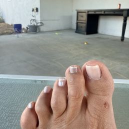 Bad pedicure Bad pedicure