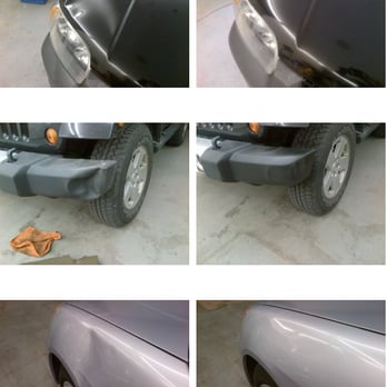 1. Dent Xpress