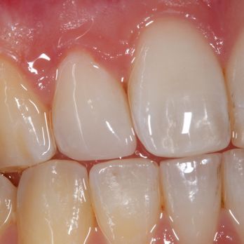 Antoine Sayegh, DDS - implantasmile - Cosmetic Dentists Near Me - Glendora, California