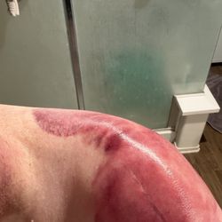 This from my first appointment