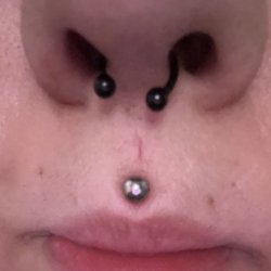World Class Tattoo - The slit above my Medusa is where the needle went through first...