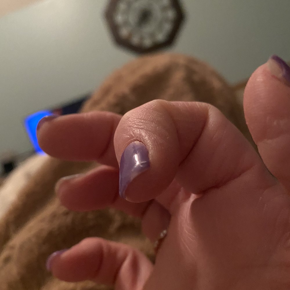 Star Nails - Top coat peeling off again next day - Nail Salons Near Me - Elgin, Illinois Star Nails - Top coat peeling off again next day - Nail Salons Near Me - Elgin, Illinois