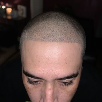 Studio 7 Aesthetics - Finished- Hairline micro pigmentation - Permanent Makeup Near Me - Fort Worth, Texas Studio 7 Aesthetics - Finished- Hairline micro pigmentation - Permanent Makeup Near Me - Fort Worth, Texas